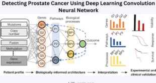 Detecting Prostate Cancer Using Deep Learning Convolution Neural Network