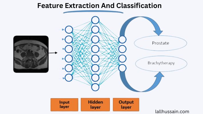 How To Detecting Prostate Cancer Using Deep Learning Convolution Neural Network?